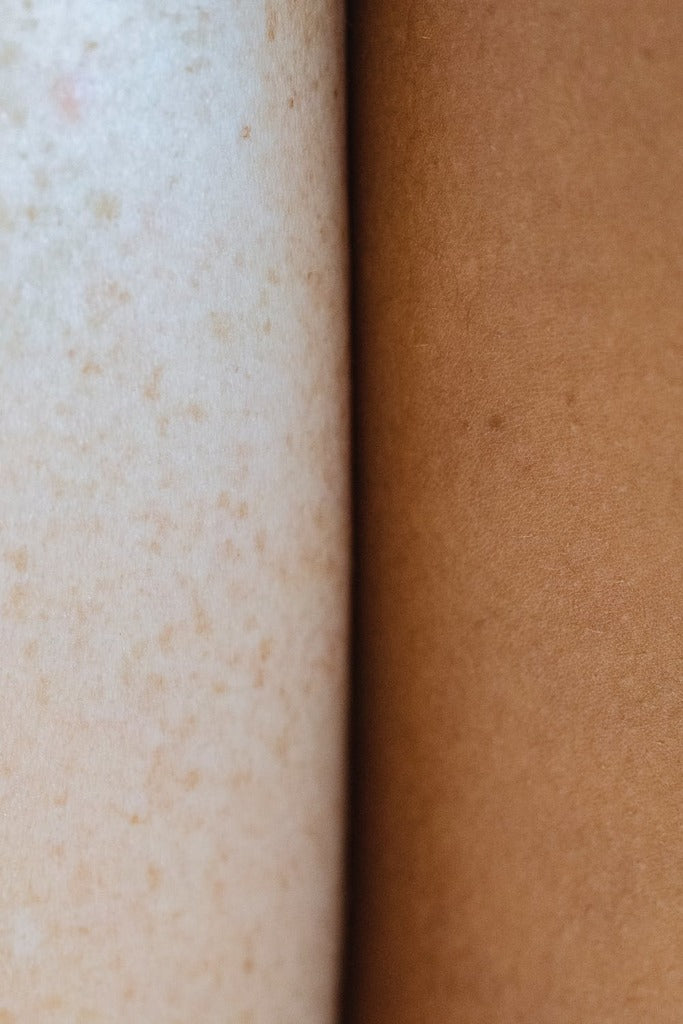 Soin du corps > épilation > traitement anti-cellulite
