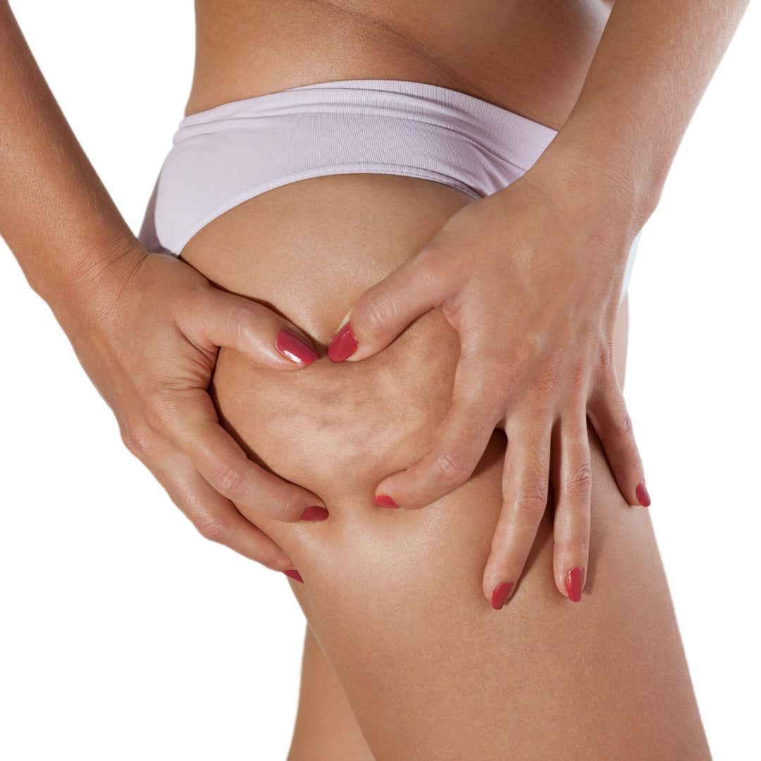 Traitement anti-cellulite